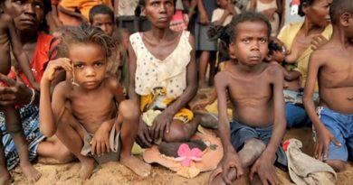 Famine Hunger Starvation povertty
