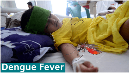 Dengue fever